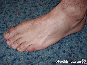 Khu solo by Foot Friends image 8